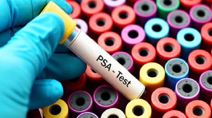 Prostat Sağlığı ve Beslenme: Sorunları Tetikleyen ve Koruyan Yiyecekler Nelerdir?