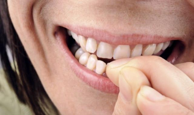 "Ah vah" demeyin! Tırnak yemekten kurtulamayanlar! Bu belanın çözümü bakın ne çıktı...