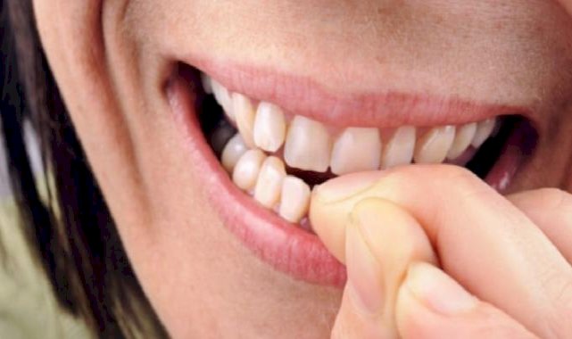 "Ah vah" demeyin! Tırnak yemekten kurtulamayanlar! Bu belanın çözümü bakın ne çıktı...