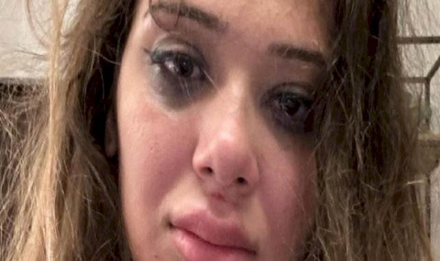 Ünlü fenomen Merve Taşkın sevgilisinden şiddet gördü! 1 yıl sonra itiraf etti