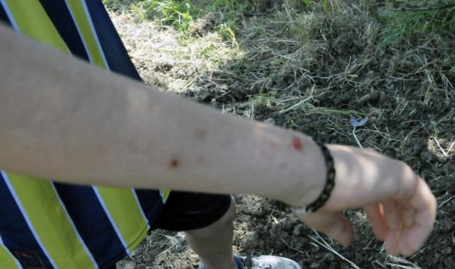 Hatay'da havalar ısınınca konteynerlerde sinek ve haşere sorunu başladı