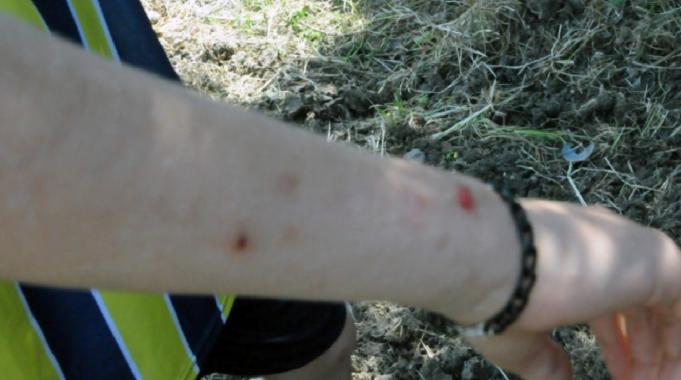 Hatay&#039;da havalar ısınınca konteynerlerde sinek ve haşere sorunu başladı