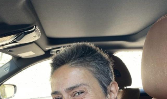 Seda Bakan da Yıldız Tilbe'ye uydu: Dişsiz fotoğrafını paylaştı