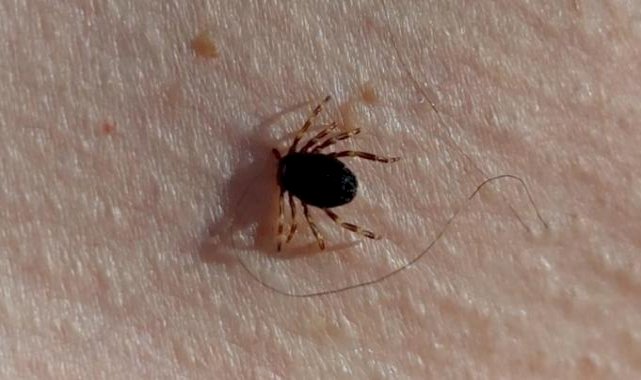 Yılın ilk kene vakası Gümüşhane'de görüldü