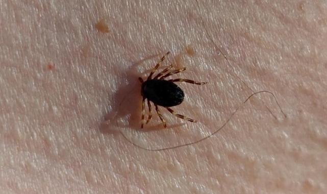 Yılın ilk kene vakası Gümüşhane'de görüldü