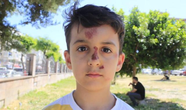 Antalya'da okula uğurladığı oğlunun kazasını çekti: Görüntünün yerini çığlıklar aldı