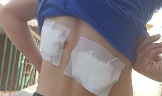 Diyarbakır'da 8 yaşındaki çocuk, sokak köpeklerinin saldırısında yaralandı