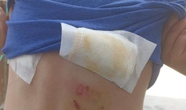 Diyarbakır'da 8 yaşındaki çocuk, sokak köpeklerinin saldırısında yaralandı