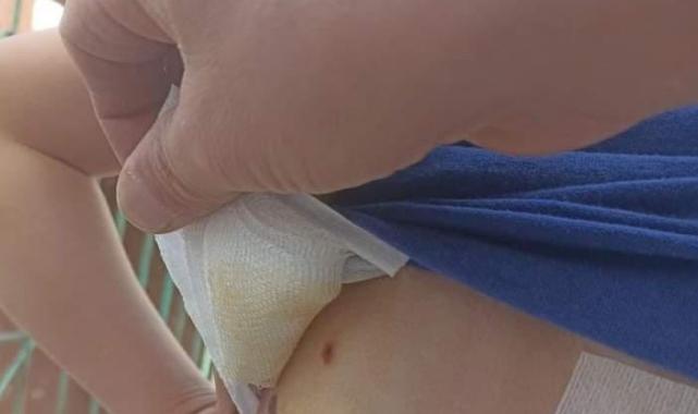 Diyarbakır'da 8 yaşındaki çocuk, sokak köpeklerinin saldırısında yaralandı