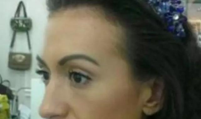 Estetiksiz halini gören şaştı kaldı! Bakın dünyanın en büyük yanaklı kadınının estetiksiz hali nasılmış…