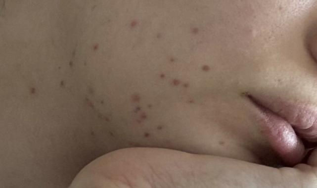 İdo'nun eşi Yasemin Şefkatli hayranlarını korkuttu