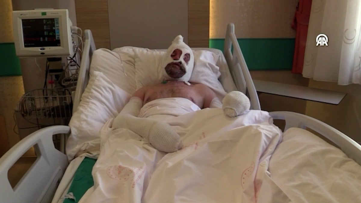 Rize'de benzin bidonu patladı vücudu yandı: Olayın etkisinden kurtulamıyorum