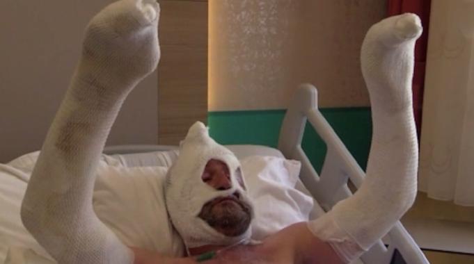 Rize&#039;de benzin bidonu patladı vücudu yandı: Olayın etkisinden kurtulamıyorum