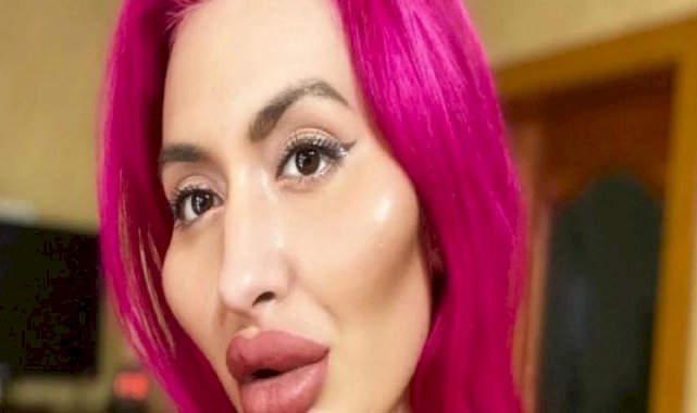 Estetiksiz halini gören şaştı kaldı! Bakın dünyanın en büyük yanaklı kadınının estetiksiz hali nasılmış…