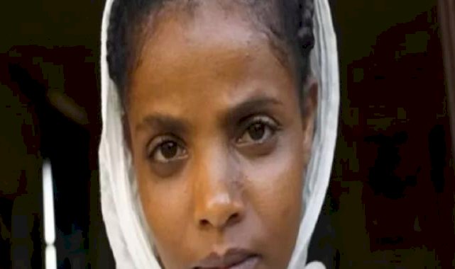 Etiyopya'da yıllardır yemeden içmeden yaşadığını söyleyen kadın doktorları şaşırttı