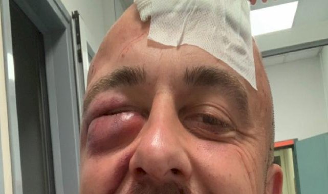 İtalya'da Filistin destekçisi Şef Rubio, Siyonist bir grup tarafından darbedildi