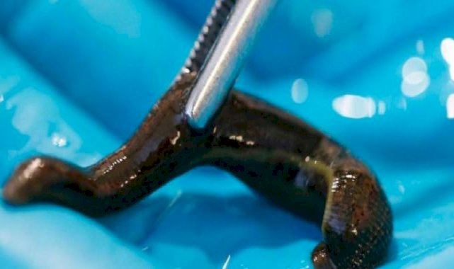 Sağlıkta yeni cihaz: Sülükler ilham kaynağı oldu