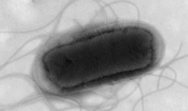 İngiltere'de koli basili alarmı: Gıdalardan bulaşıyor