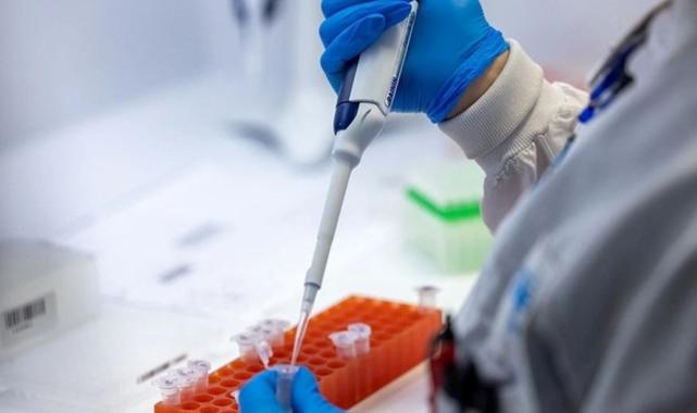 Prof. Dr. Özlü’den ‘A (H5N2)’ açıklaması: Anormal bir durum görmüyorum