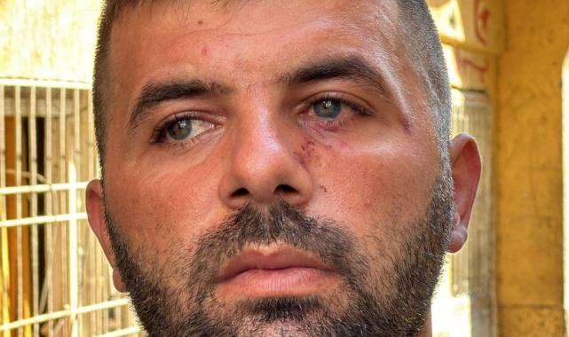 Adana'da işkenceye uğrayan hurdacı şikayetçi oldu