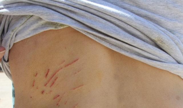 Antalya'da iki kadın besledikleri kedinin saldırısına uğradı