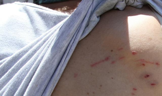 Antalya'da iki kadın besledikleri kedinin saldırısına uğradı