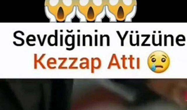Çanakkale'de masaj salonunda kadın çalışanın yüzüne kezzap atan sanık hakim karşısında