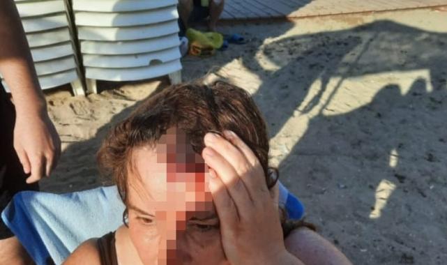 Denizde yüzerken jet ski çarptı, ölümden döndü