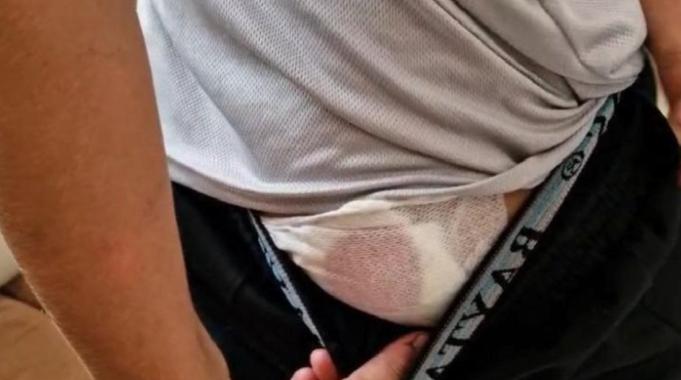 Diyarbakır&#039;da ekmek almaya giden çocuğa köpek saldırdı