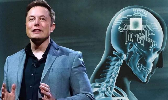 Elon Musk 2026'ya kadar bin kişiye çip takmayı hedefliyor