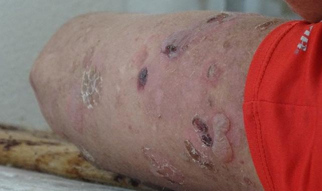 Hakkarili Amar'ın sesi duyuldu: Tedavi olacak