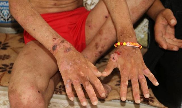 Hakkarili Amar'ın sesi duyuldu: Tedavi olacak