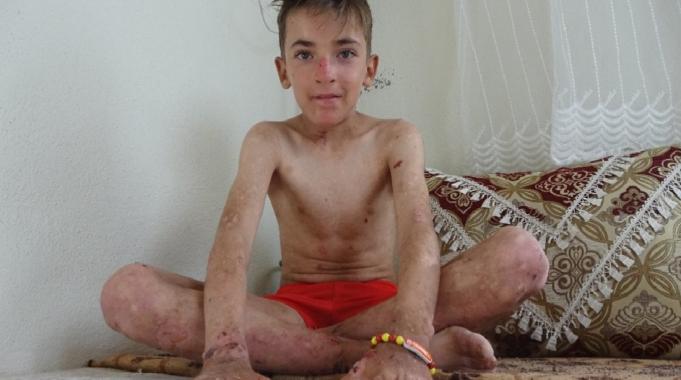 Hakkarili Amar'ın sesi duyuldu: Tedavi olacak