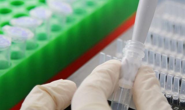 Kaşar peynirinde kullanımı yasak maddeler tespit edilecek