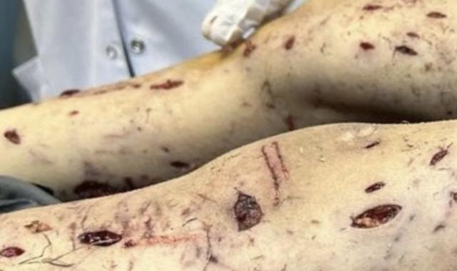 Köpeklerin saldırısında yaralanan Tunahan'ın babasından muhalefet vekillerine tepki