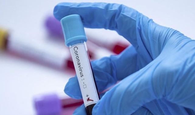 Koronavirüsün yaz dalgası geldi: FLiRT hızla yayılıyor