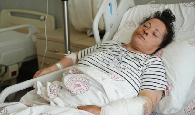 Niğde'de bir kadın iki köpeğin saldırısına uğradı