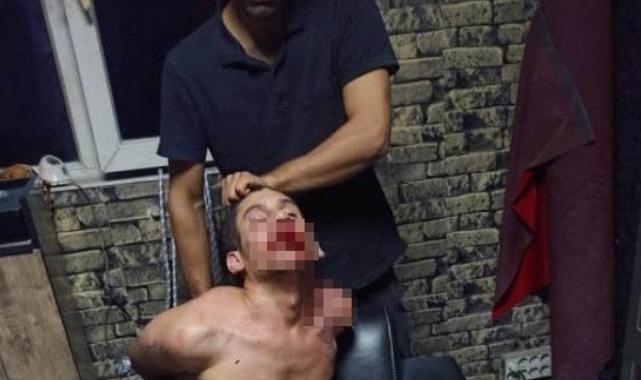 Şanlıurfalı gence akılalmaz işkence: Böcek yedirdiler, kerpetenle dişlerini söktüler