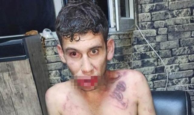 Şanlıurfalı gence akılalmaz işkence: Böcek yedirdiler, kerpetenle dişlerini söktüler
