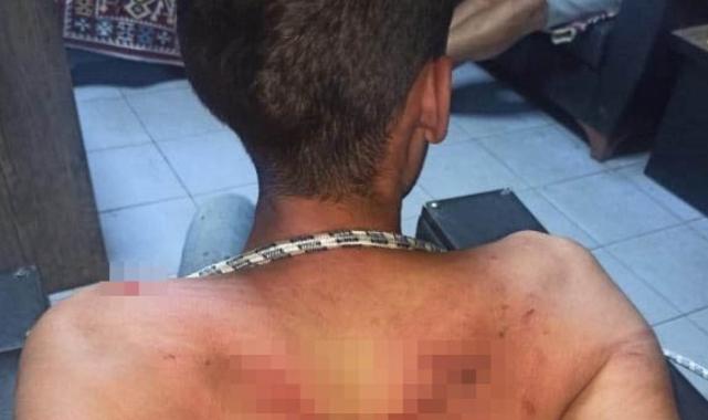 Şanlıurfalı gence akılalmaz işkence: Böcek yedirdiler, kerpetenle dişlerini söktüler