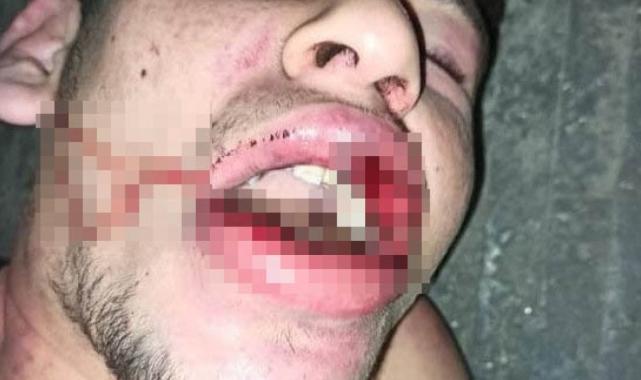 Şanlıurfalı gence akılalmaz işkence: Böcek yedirdiler, kerpetenle dişlerini söktüler