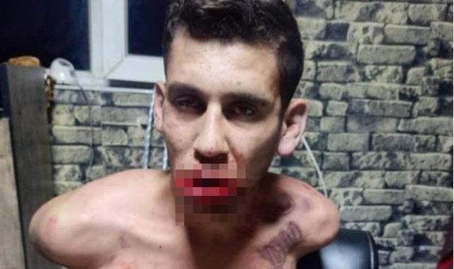 Şanlıurfalı gence akılalmaz işkence: Böcek yedirdiler, kerpetenle dişlerini söktüler