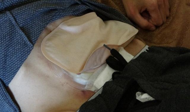 Suriyeli hasta, kayıt probleminden dolayı tedavi olamıyor