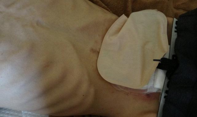 Suriyeli hasta, kayıt probleminden dolayı tedavi olamıyor