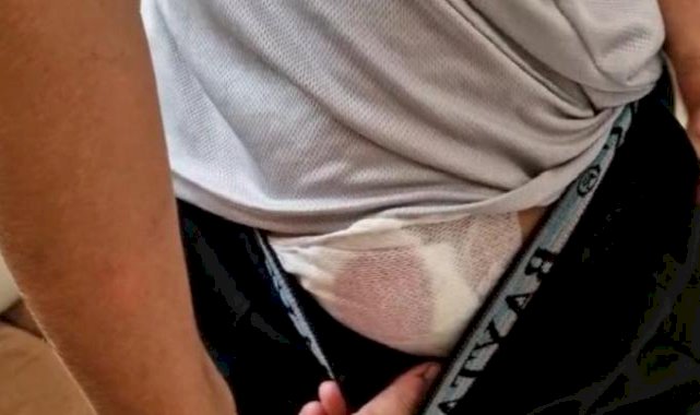 Diyarbakır'da ekmek almaya giden çocuğa köpek saldırdı