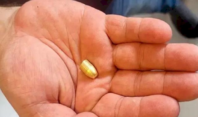 Şanlıurfa'da 4 yaşındaki çocuğa yorgun mermi isabet etti