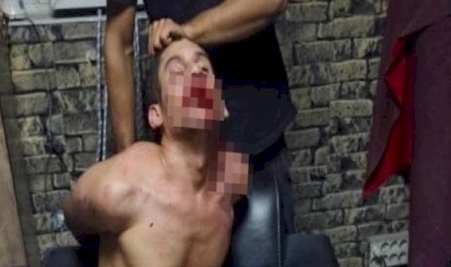 Şanlıurfalı gence akılalmaz işkence: Böcek yedirdiler, kerpetenle dişlerini söktüler