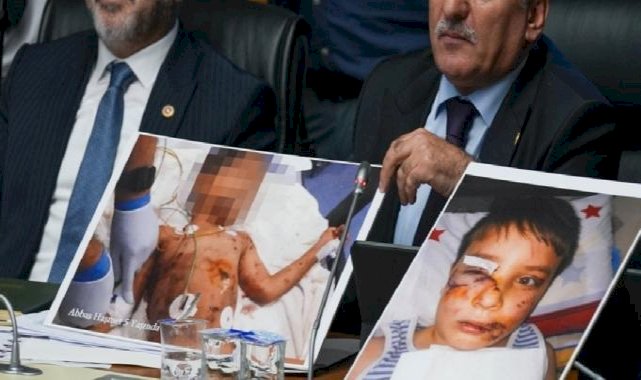 TBMM komisyonunda başıboş köpek kurbanı çocukların fotoğrafları gösterildi