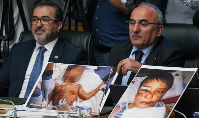 TBMM komisyonunda başıboş köpek kurbanı çocukların fotoğrafları gösterildi