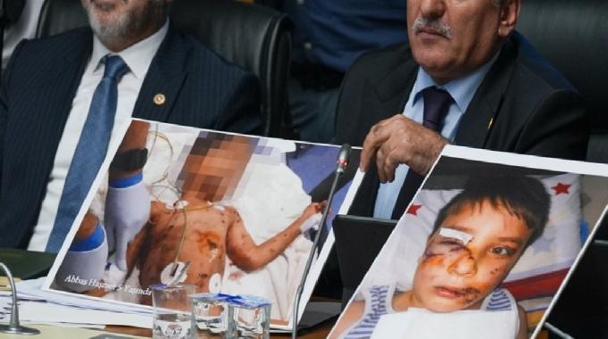 TBMM komisyonunda başıboş köpek kurbanı çocukların fotoğrafları gösterildi